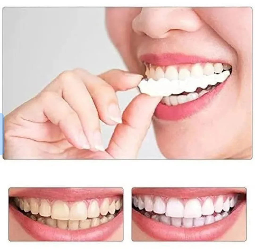 Instant Teeth Whitening Cover – Natural Veneer Tooth Cap for Perfect Smile | Reusable Fake Teeth