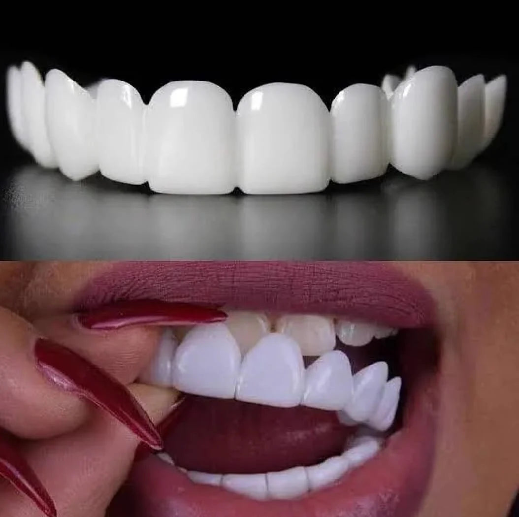 Instant Teeth Whitening Cover – Natural Veneer Tooth Cap for Perfect Smile | Reusable Fake Teeth