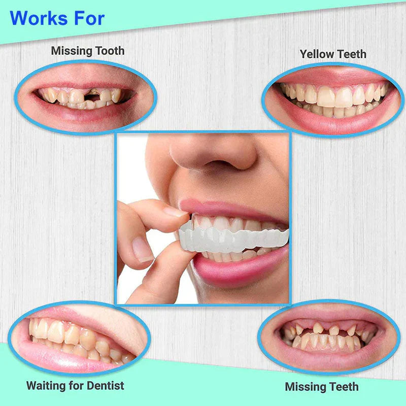 Snap on Smile teeth Braces